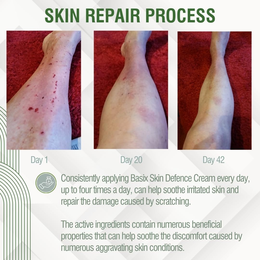 Basix Skin Defence Cream (4 Pack) Moisturising Repair Cream for Seriously Dry Skin with Kigelia Africana - suitable for Eczema, Psoriasis and Dermititis